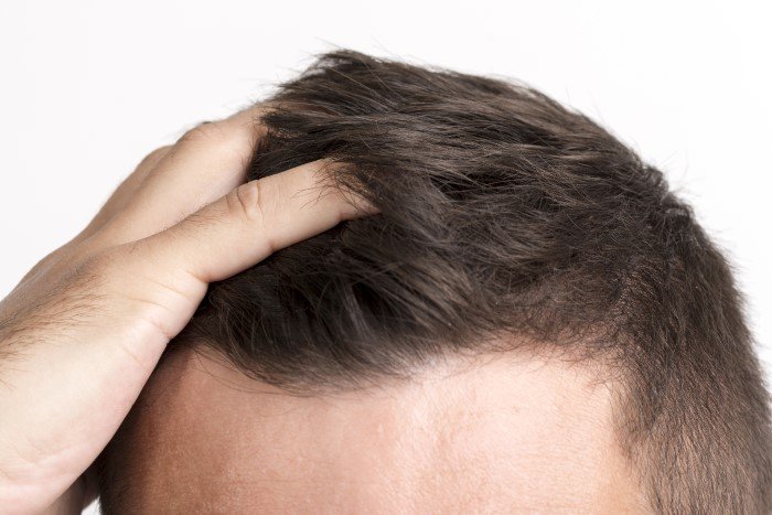 Organik Saç Ekimi Nasıl Yapılır?