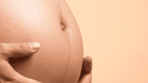 hamilelikte çatlak önleyici yağlar 